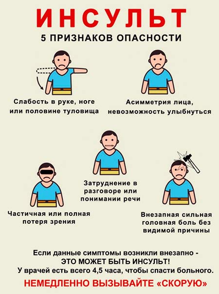 Информация об инсульте